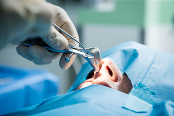 Formation de dissection de chirurgie endonasale : Apprendre les techniques de chirurgie endoscopique
